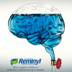 Acrylic Brain & Tap Model